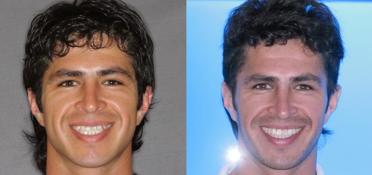 patient-Miguel oxford al orthodontics