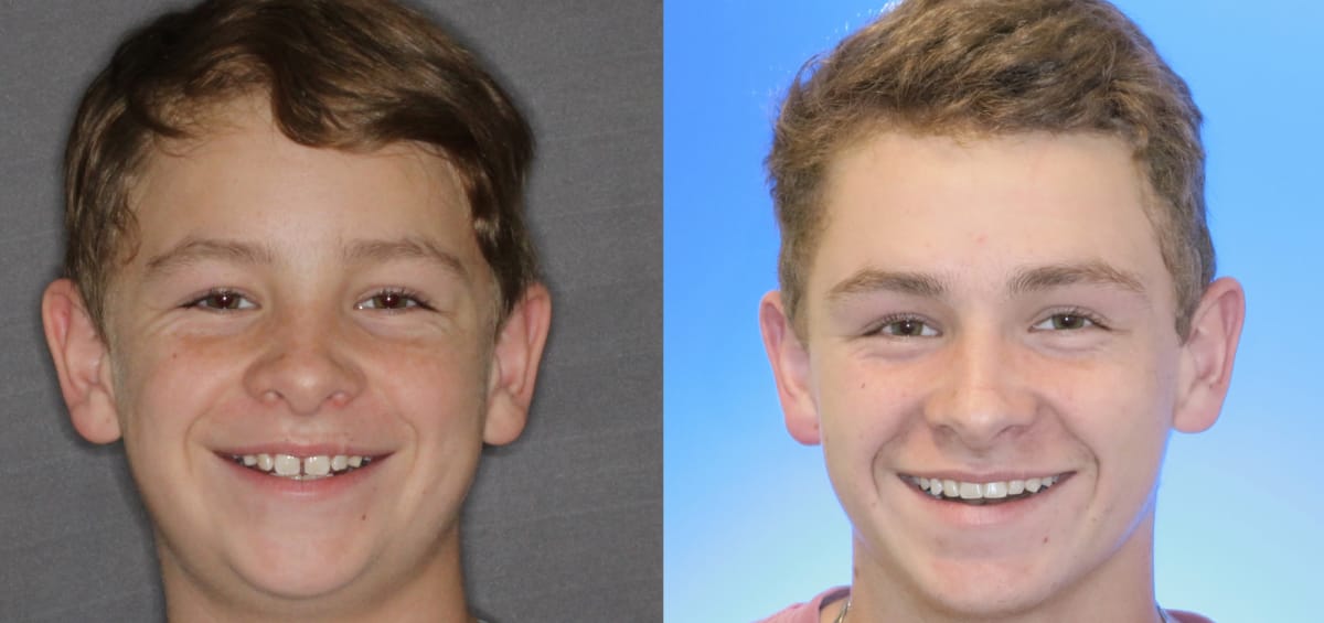 patient-Richard oxford al orthodontics