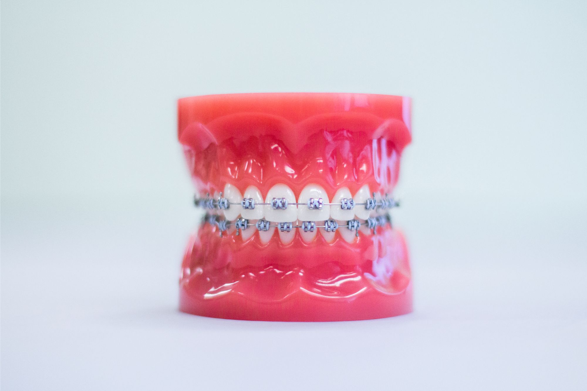IMG_5819 Braces on a teeth mold