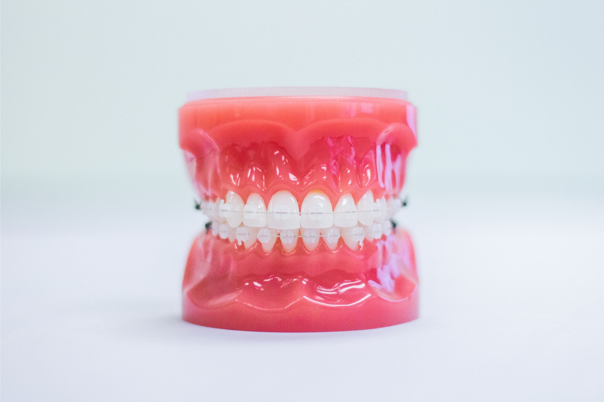 Clear braces on a teeth mold