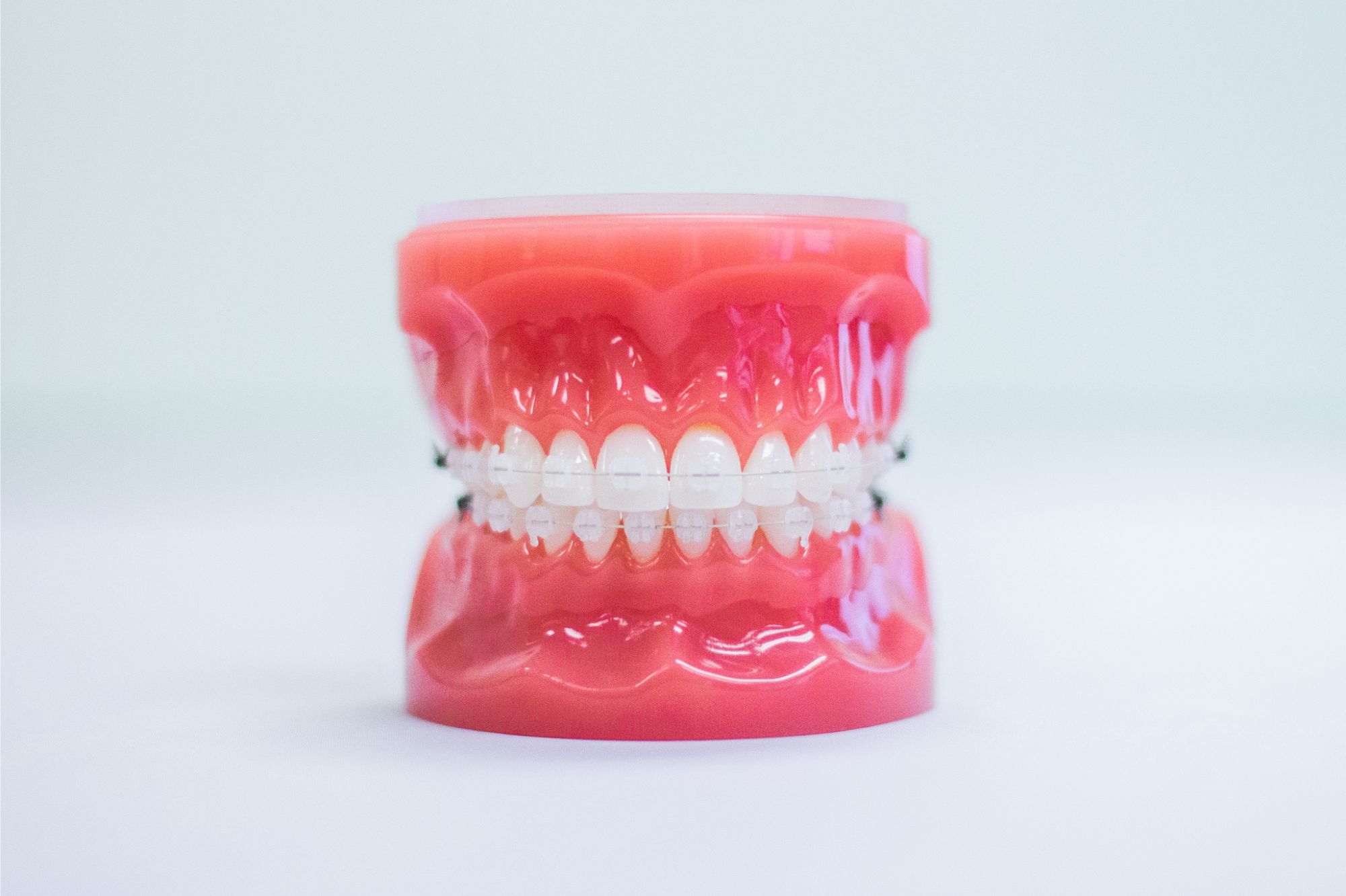 IMG_5857 Clear braces on a teeth mold