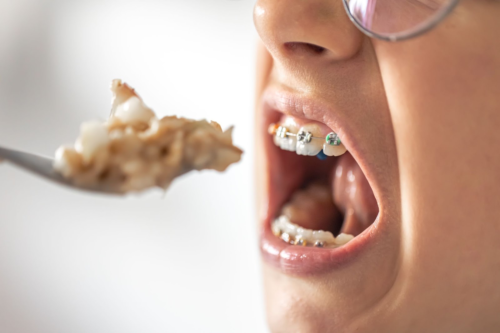 Your Guide to Braces-Friendly Pell City Dining