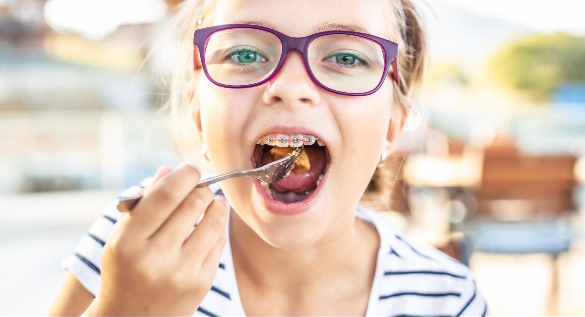 Your Guide to Braces-Friendly Pell City Dining